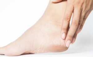 Pecah-pecah pada Tumit Kaki? Ini 5 Cara Menghilangkannya secara Permanen